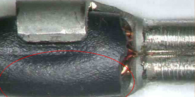 外皮包脚断裂图片案例展示